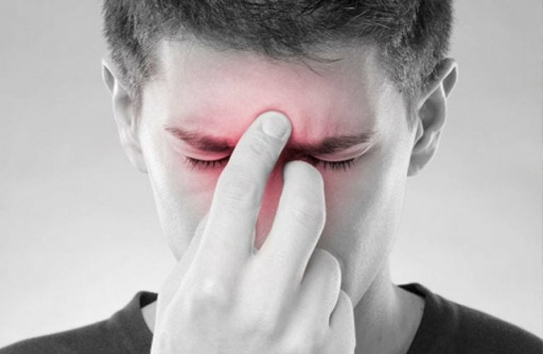 sinusitis2